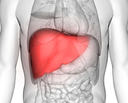 Liver transplant