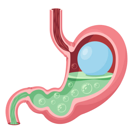 Bariatric Surgery