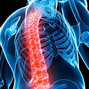 Spinal Disorders