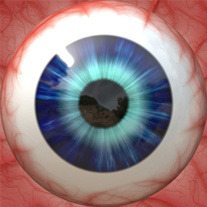 Cornea Transplant